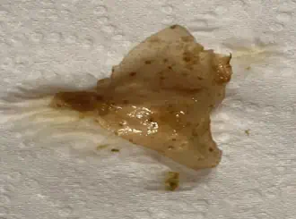 Biofilm on tissue